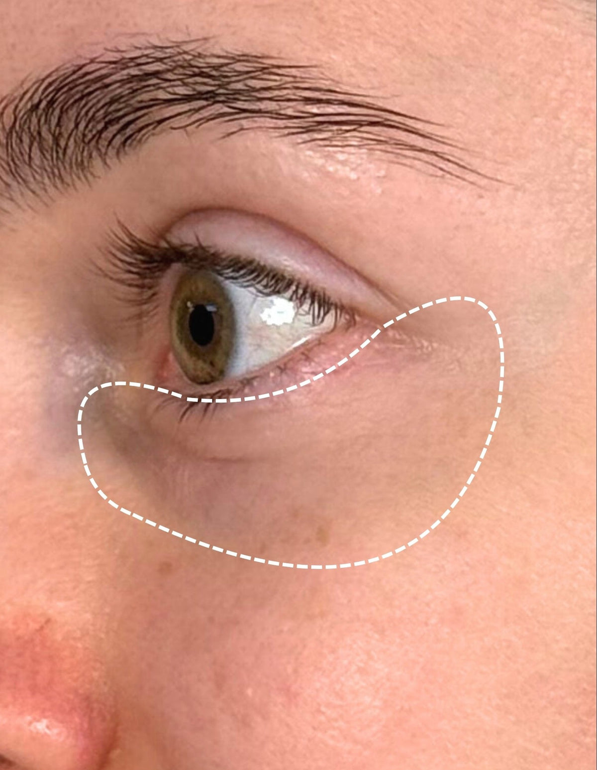 Nadiia after 4 weeks of LumaLux Face