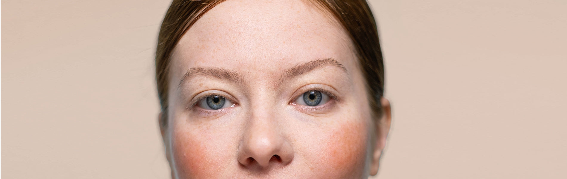 Reducing Redness: How LED Light Therapy Can Soothe Rosacea Symptoms