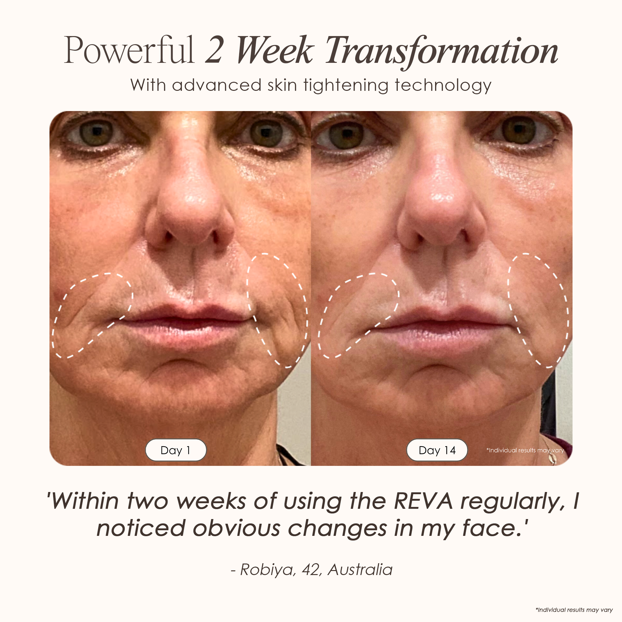 visible results after 14 days of using the LED light therapy wand