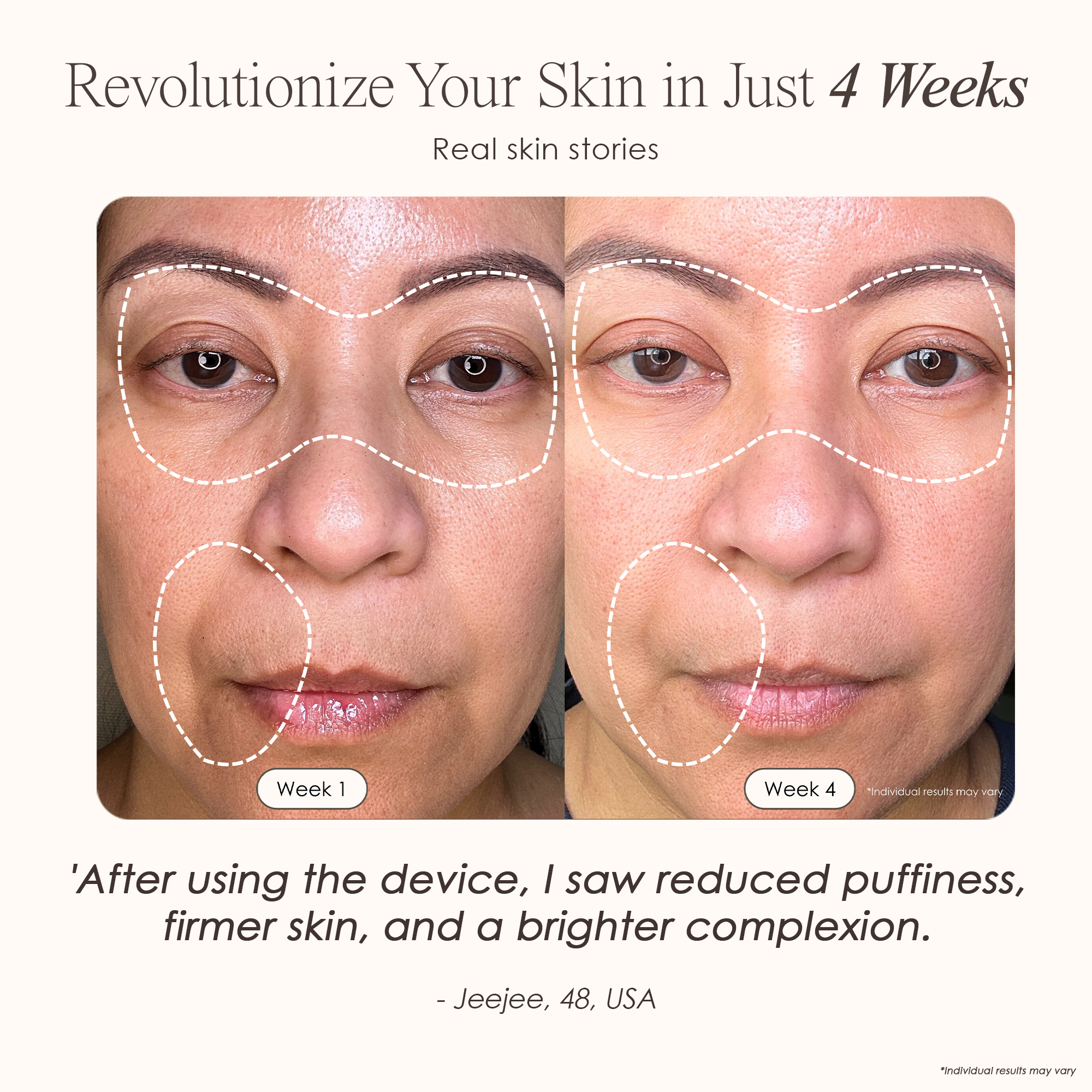 visible results after 30 days of using the LED light therapy mask