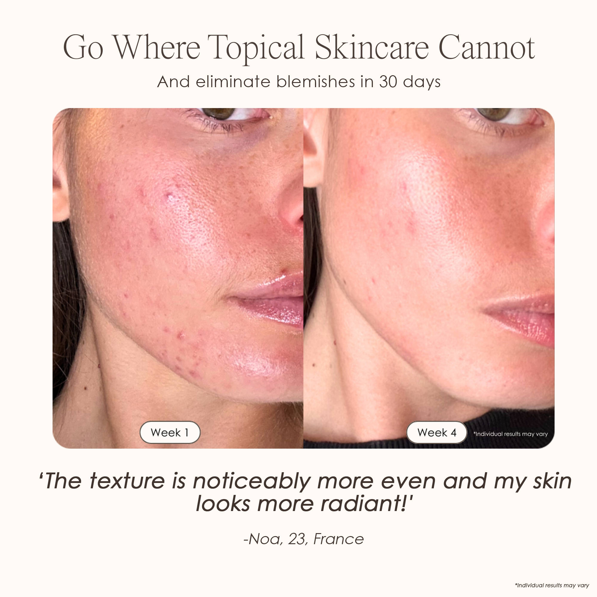 visible results after 30 days of using the LED light therapy mask