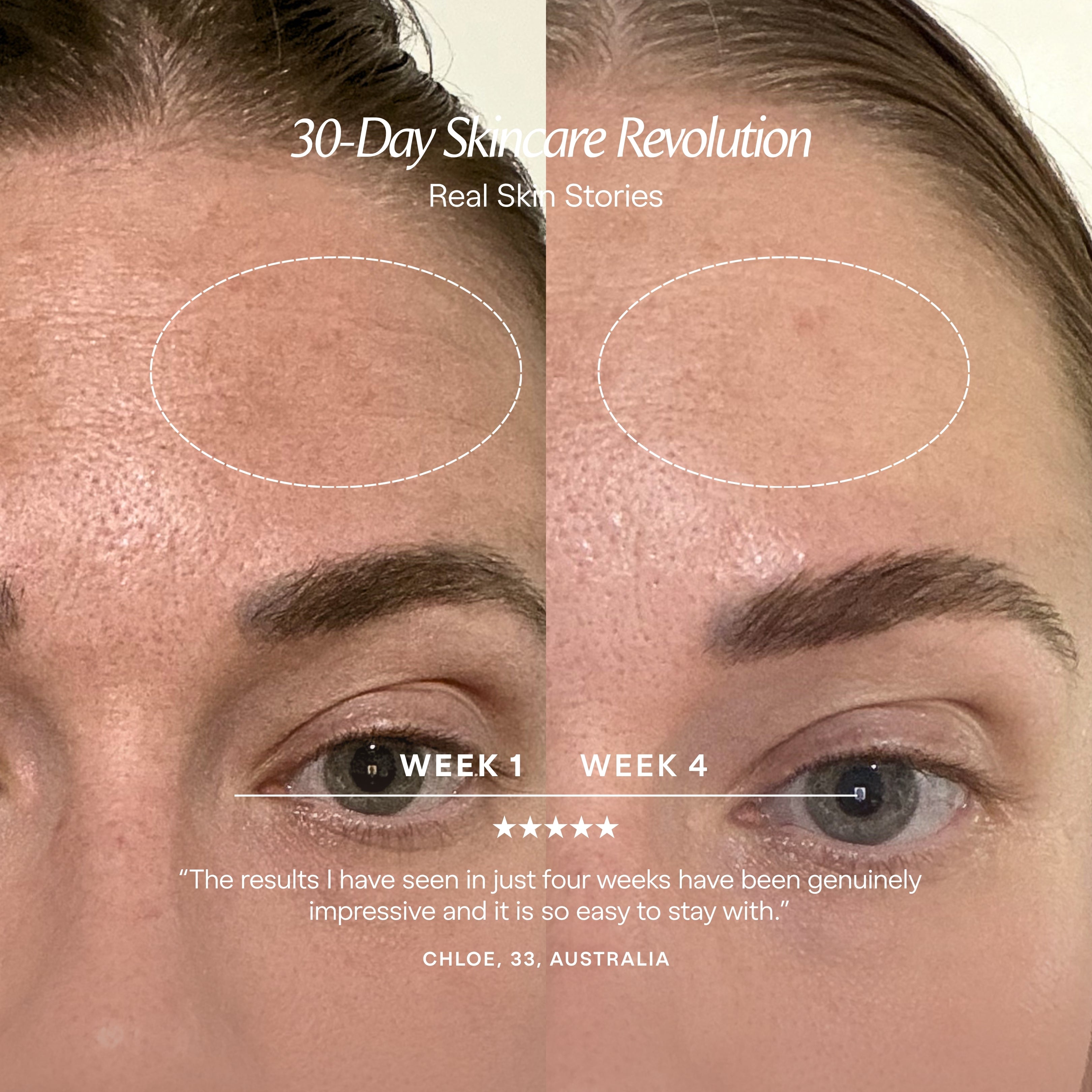 Alora | Age Renewal LED Light Therapy Panel - Project E Beauty